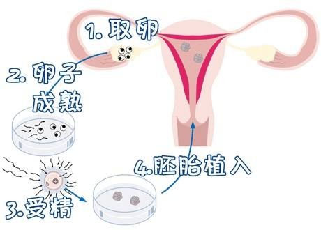 供卵试管选性别代生咨询